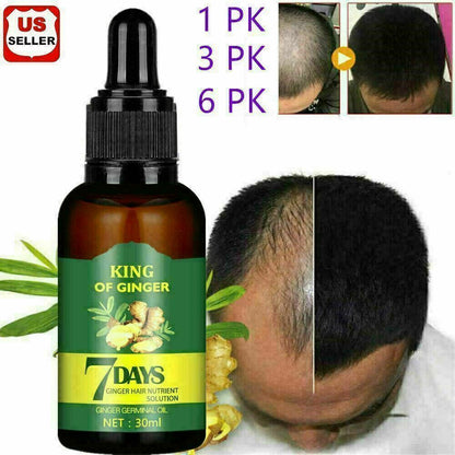 Regrow 7 Day Ginger Germinal Hair Growth Serum Hairdressing Oil Loss Treatment