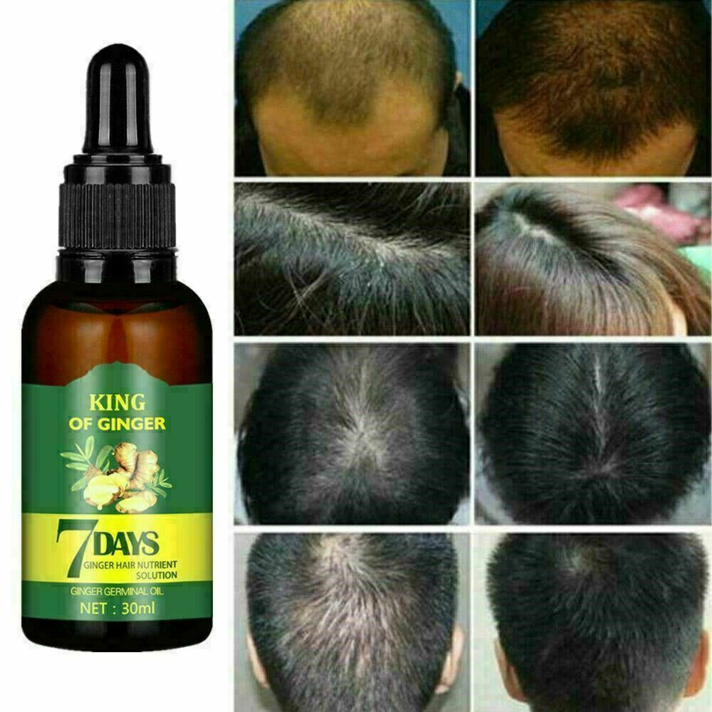 Regrow 7 Day Ginger Germinal Hair Growth Serum Hairdressing Oil Loss Treatment