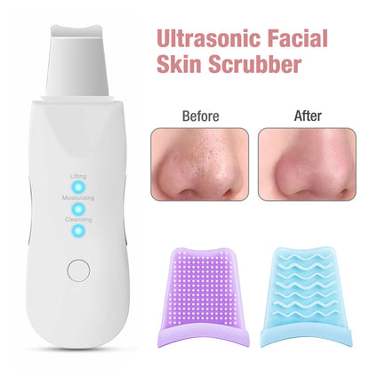 Ultrasonic Facial Scrubber Pore Blackhead Remover