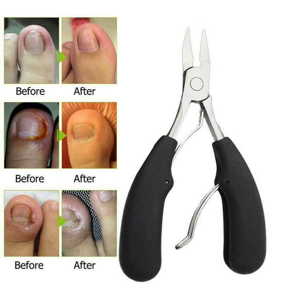 Toenail Clippers for Thick Ingrown Toe Nails